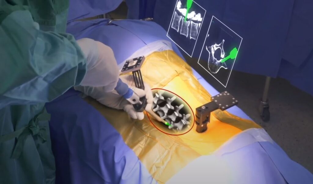 Augmedics uses AR to let surgeons see the patient's CT scan "through" their body